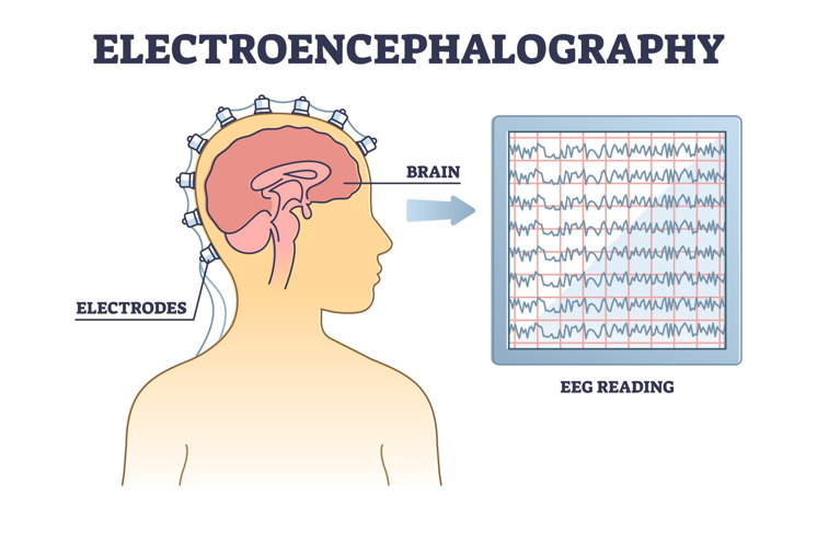Attention 기반의 장단기적 시간 정보를 활용한 EEG 감정인식 모델 image 1