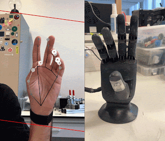 그림2. Hand Pose Estimation으로 의수률 제어하는 MIRRU 프로젝트 2.